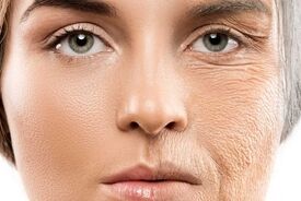 پوست شما چند ساله است؟ ۳ عادت روزانه برای جوان نگه داشتن آن