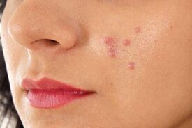 مناسب ترین شوینده برای پوست کدام است؟