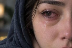 پف چشم بعد از گریه؛ علت تورم و قرمزی موقت پلک‌ها