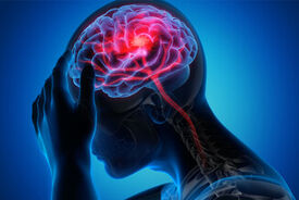 سکته هشداردهنده چیست؟
