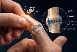 «تق» انگشت‌ها؛ دشمن مفاصل یا یک باور قدیمی