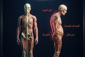 دو نفر، یک وزن؛ اما دو بدن کاملاً متفاوت! راز پنهان در فرم بدن
