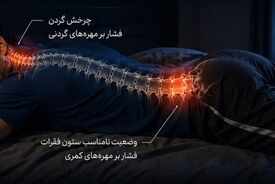 دمر خوابیدن؛ عادتی که می‌تواند عامل کمردرد و گردن‌درد صبحگاهی باشد